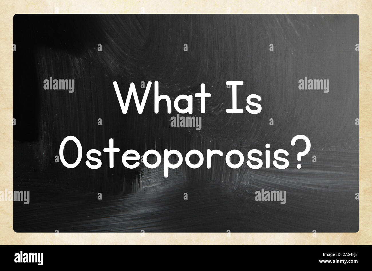 what is osteoporosis? Stock Photo