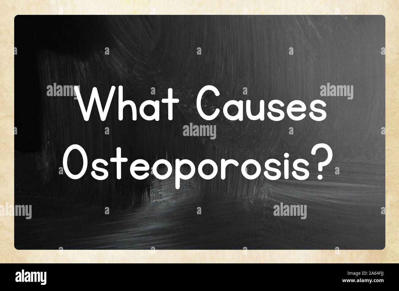 what causes osteoporosis? Stock Photo