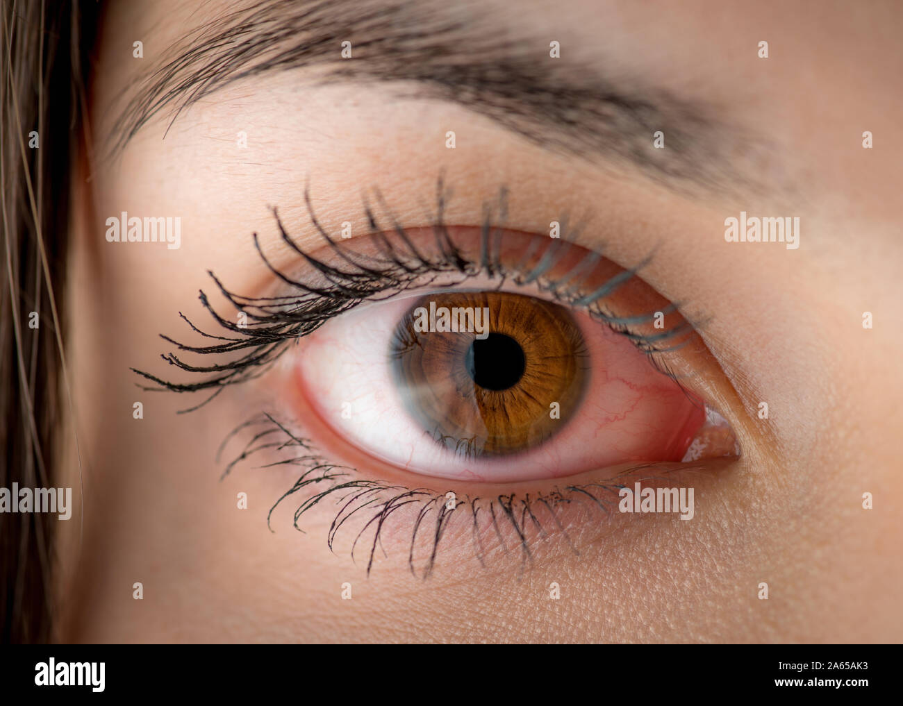 Macro of red woman eye. Bloodshot eye conjunctivitis or allergic