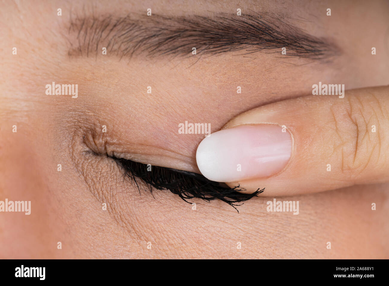 Close Up Of A Woman Massaging Infected Eye Stock Photo