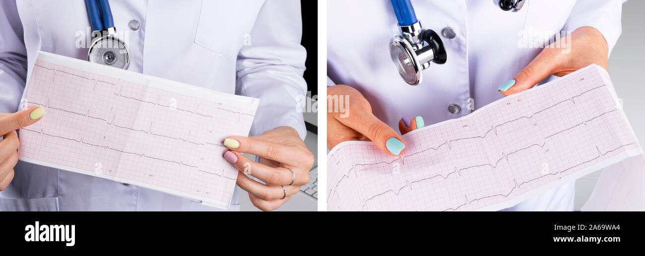 Set of Electrocardiogram, ecg in hand of a female doctor. Medical ...