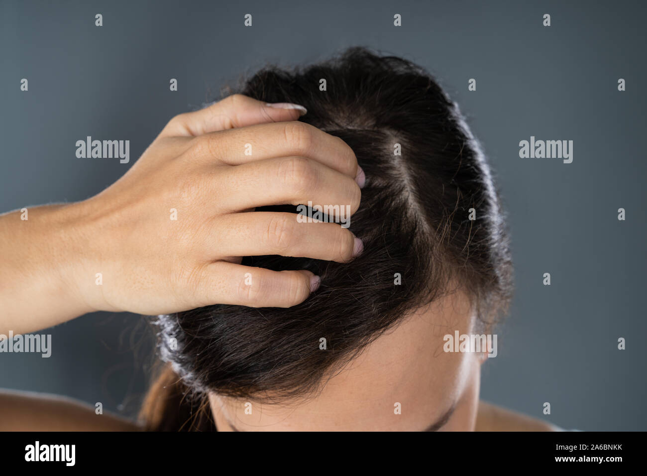 Young Woman Scratching Her Itchy Head Scalp Stock Photo