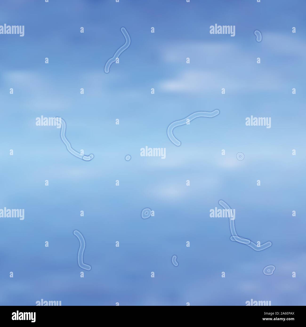 Floaters in the eye, medical visual symptom in optics Stock Vector