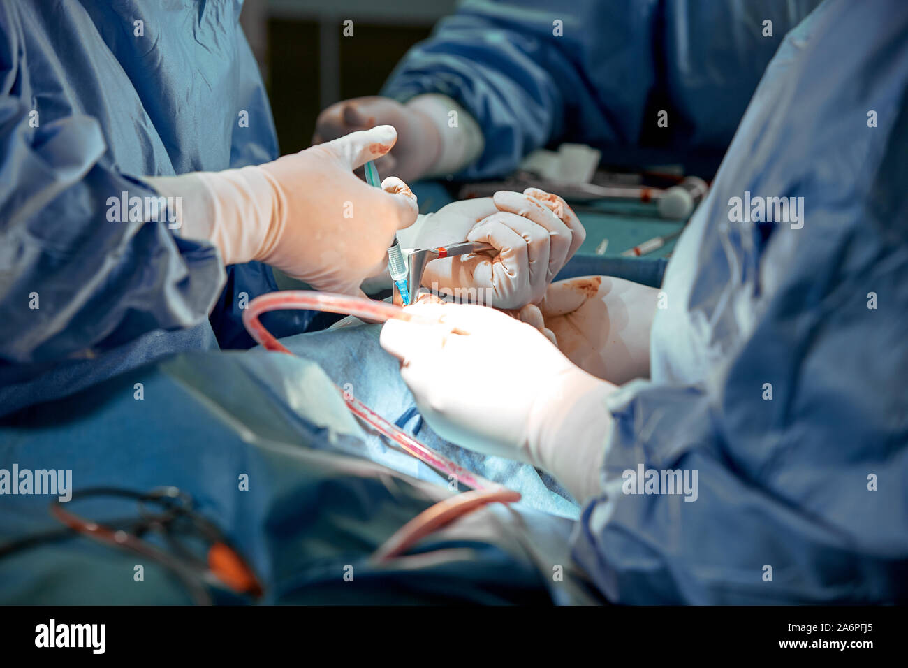Rhinoplasty closeup. An operating team of several doctors performs