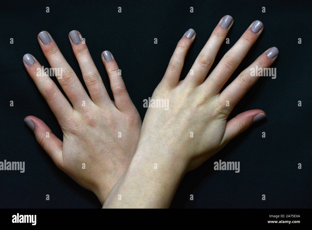 Human Fingers Anatomy High Resolution Stock Photography and Images Alamy