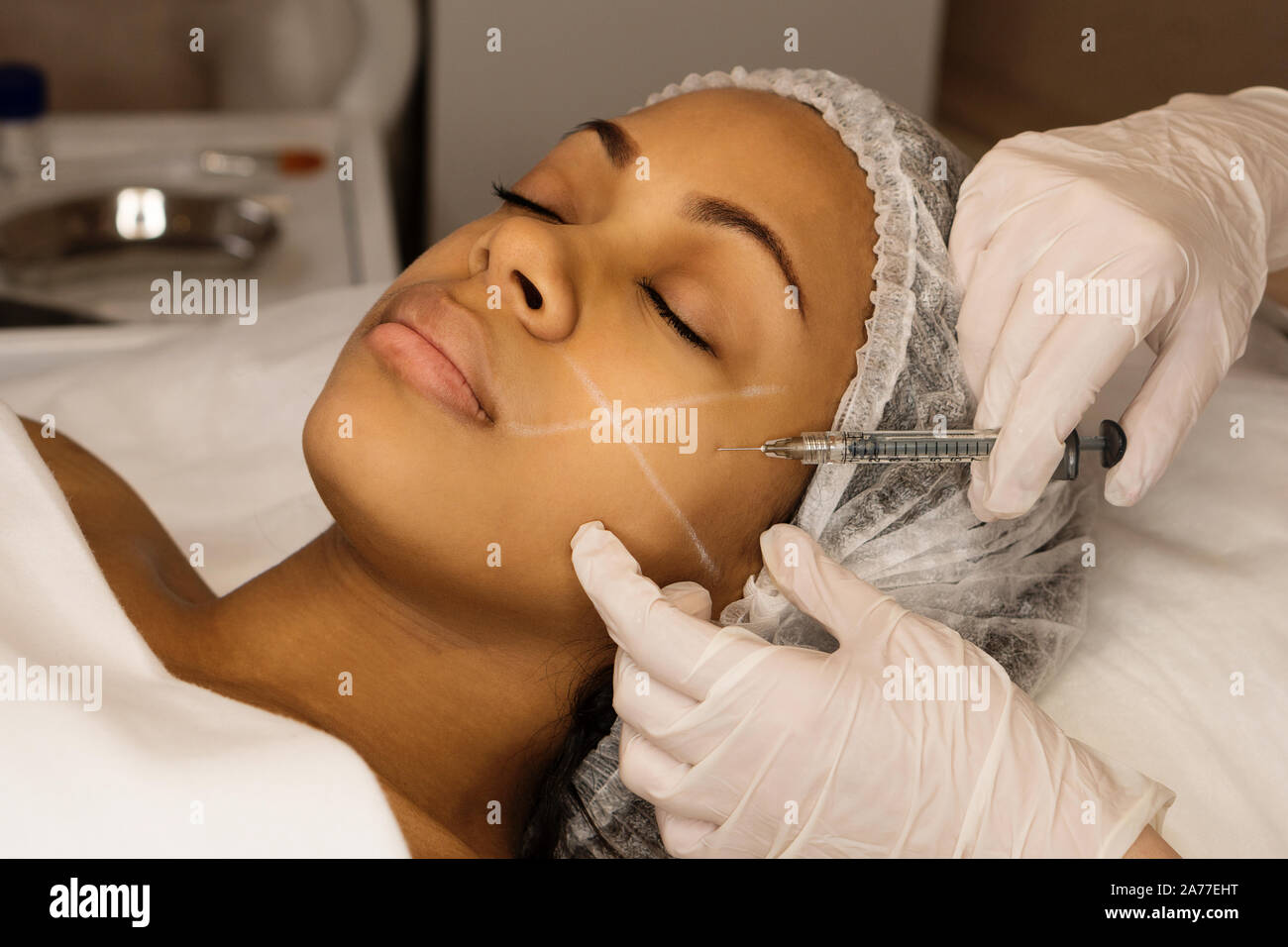 Aesthetic corrective treatments concept. Cosmetology. Facelift in spa salon. Beautician makes injections afro american girl in cheekbone. Smoothing of Stock Photo