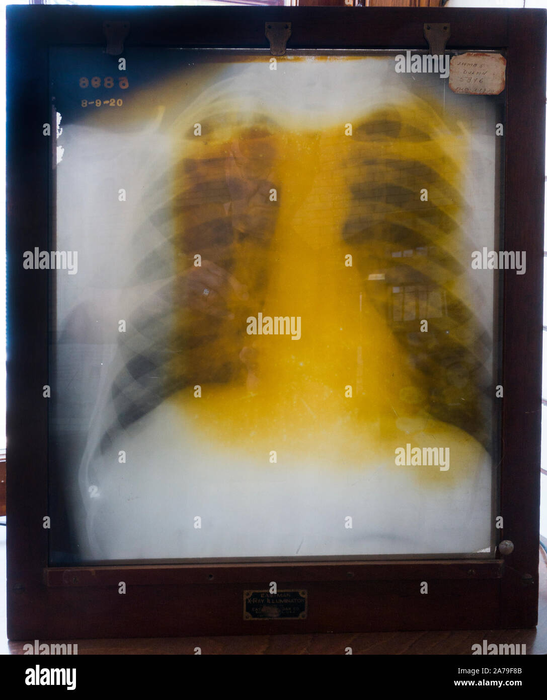 Saranac Laboratory Museum in Lake Saranac New York Stock Photo - Alamy