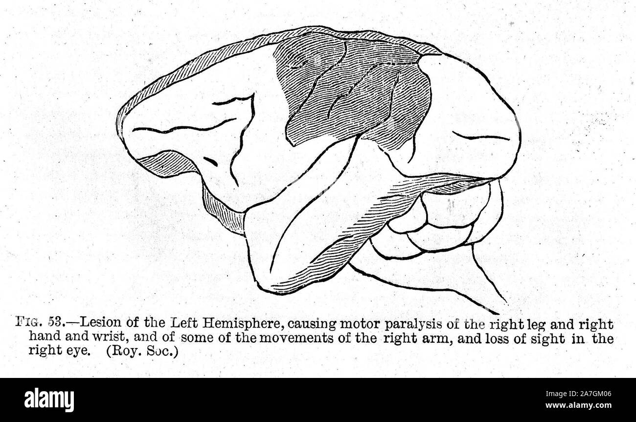 Left side of the brain hi-res stock photography and images - Alamy