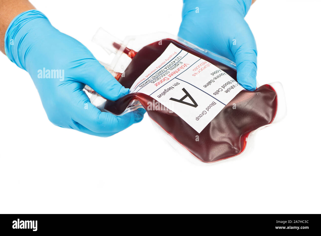 Type A volunteer donated blood unit prepared by gloved hands isolated on white. Stock Photo