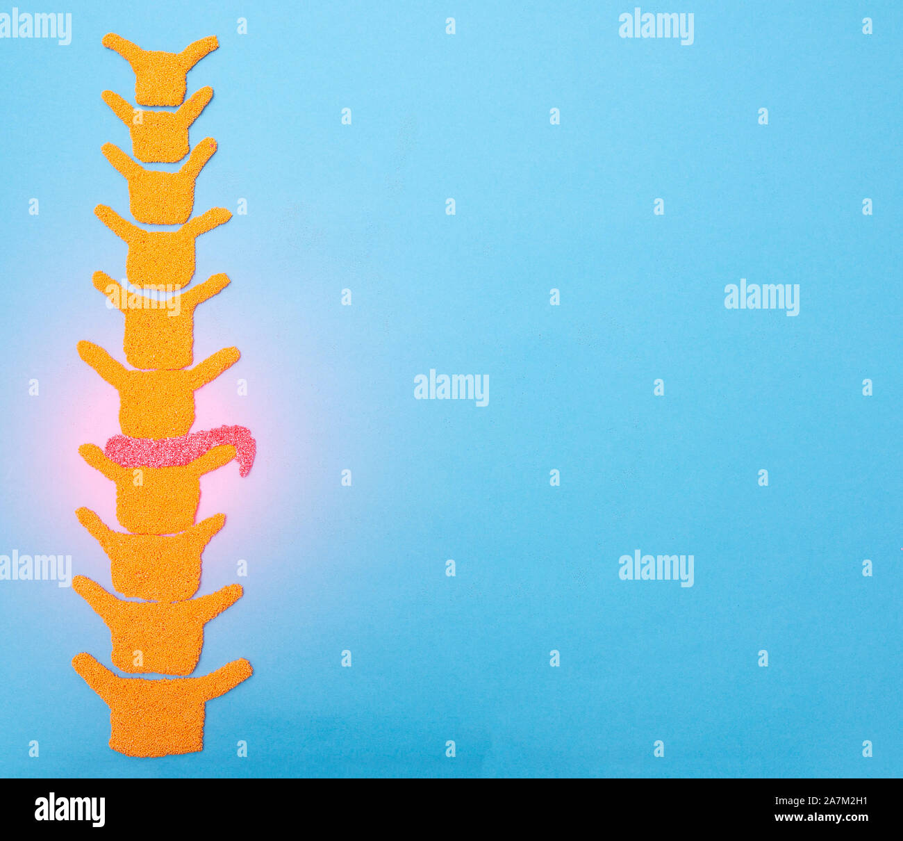 Laminectomy cervical hi-res stock photography and images - Alamy