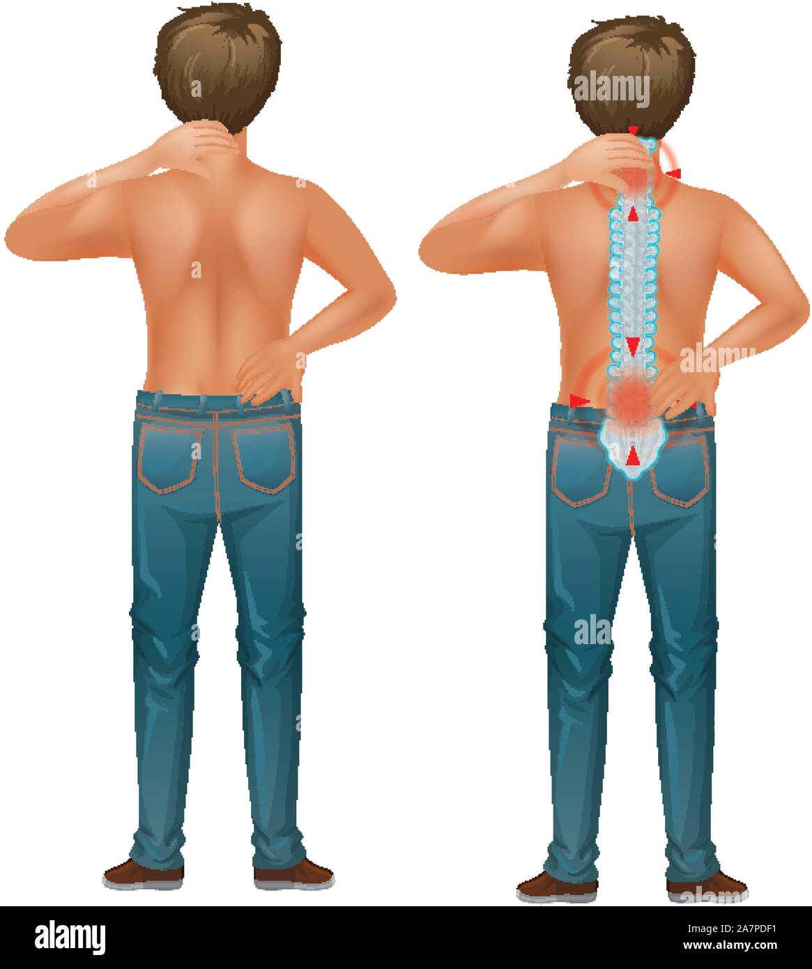 Back pain illustration hi-res stock photography and images - Alamy