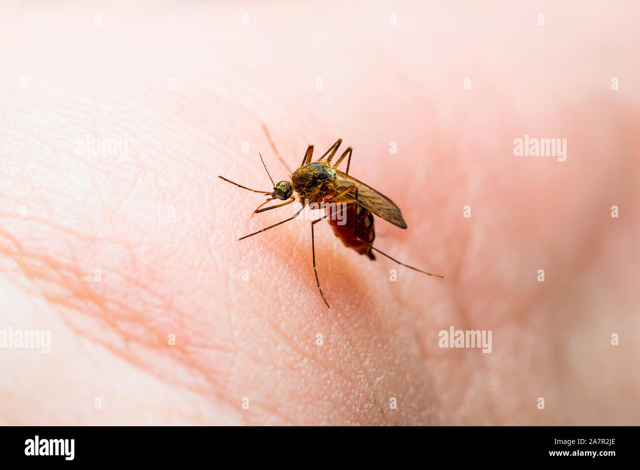 Cukes Insect Injury Encephalitis, Yellow Fever, Malaria Disease or Zika Virus Infected ...
