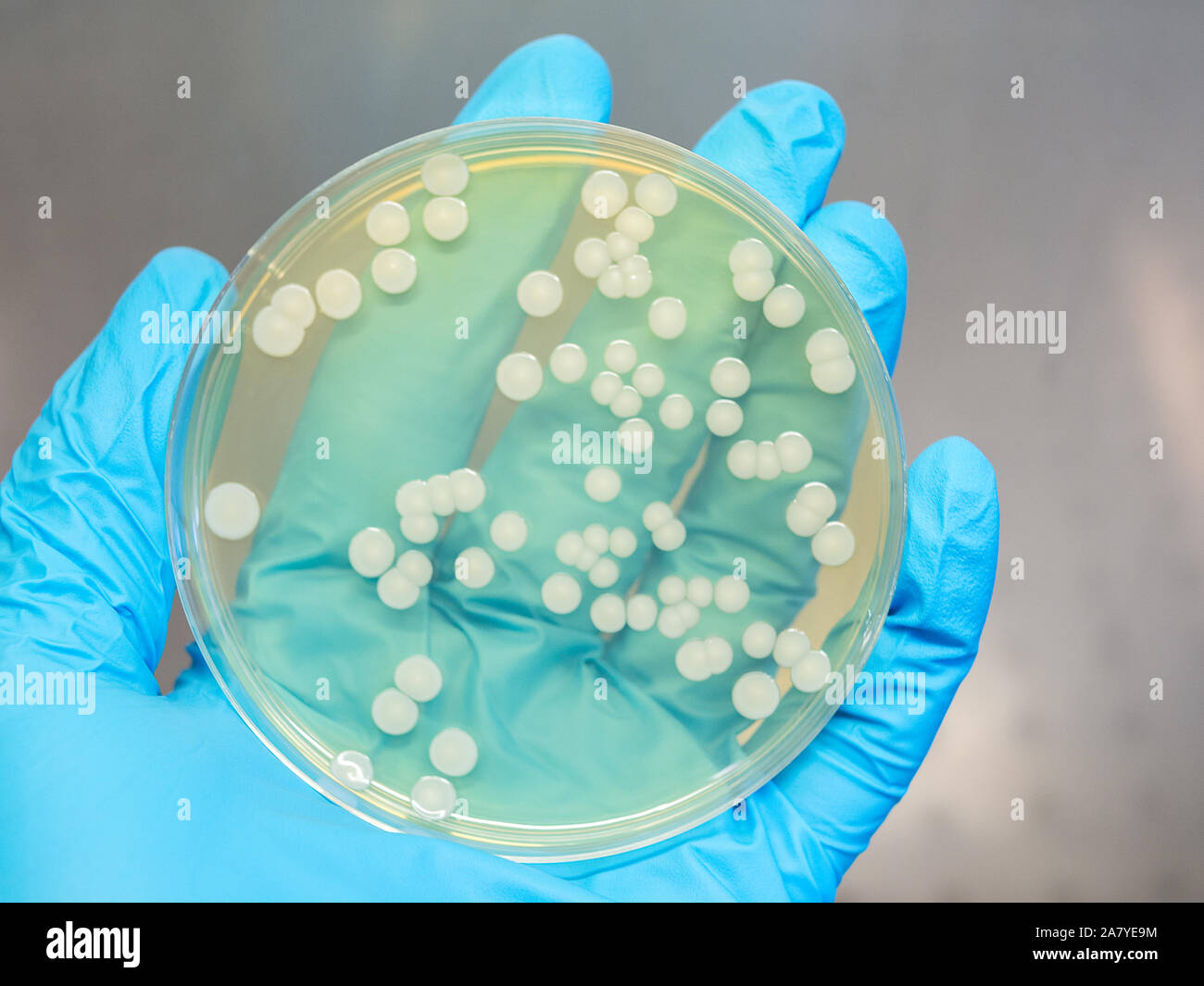 hand holding a petri dish with isolated bacteria colonies in a laminar
