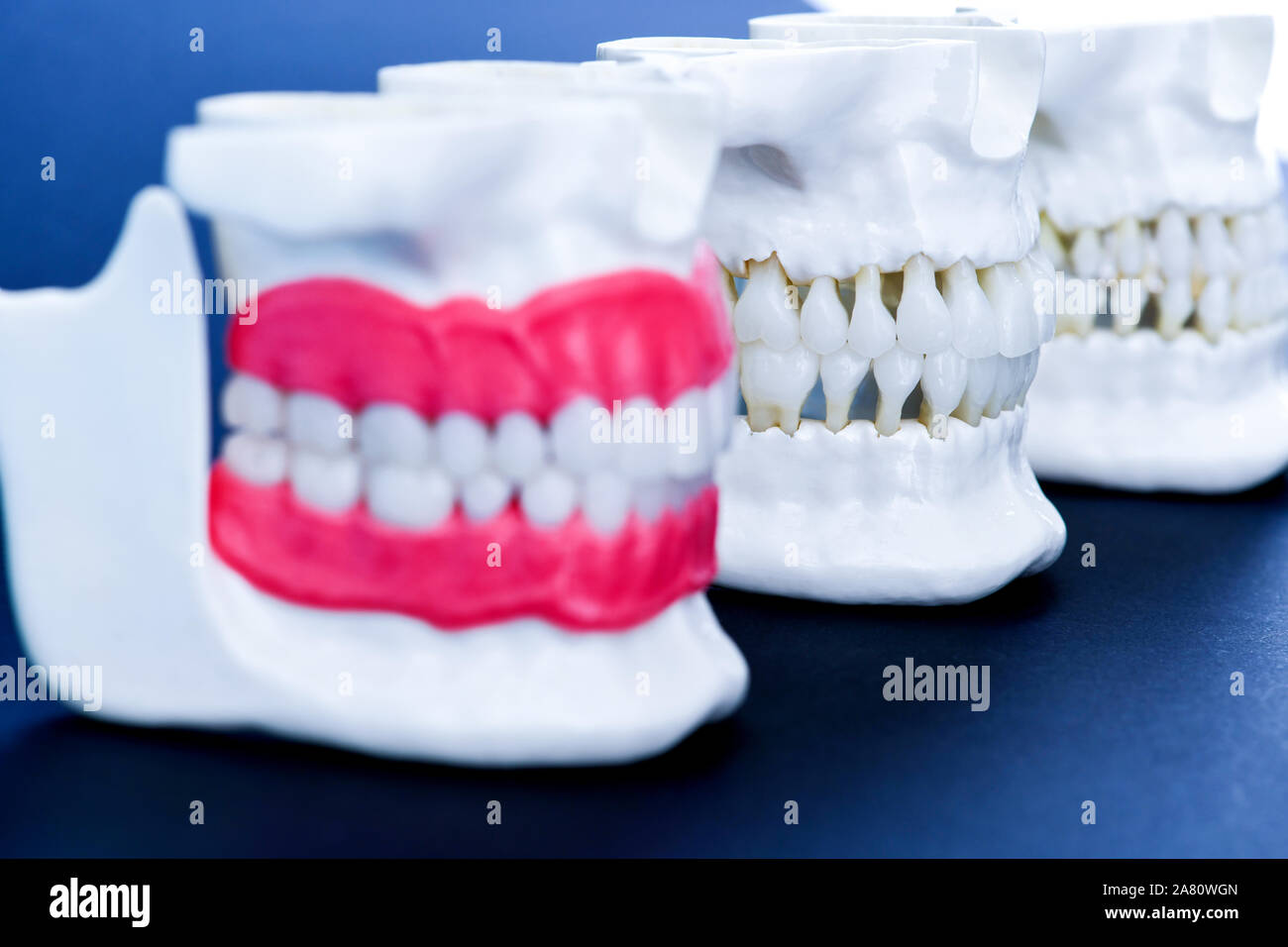 Human jaws with teeth and gums anatomy models medical illustration