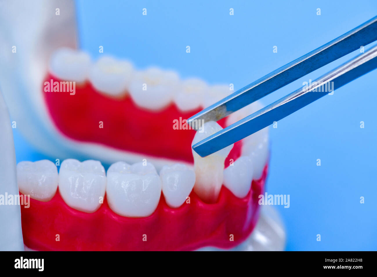 tweezers pulling tooth from the lower jaw anatomy model medical