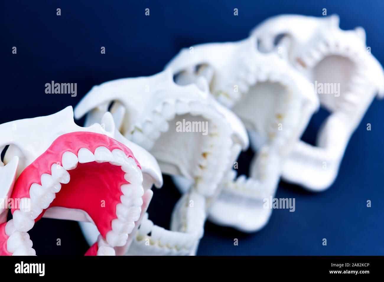 Dentist orthodontic teeth models with jaws opened on blue background ...
