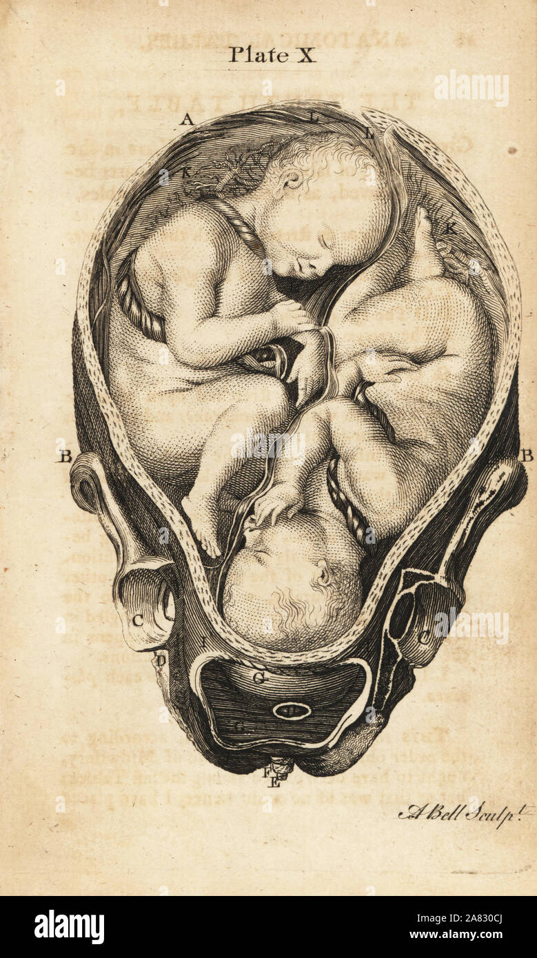 Twins in utero hi-res stock photography and images - Alamy