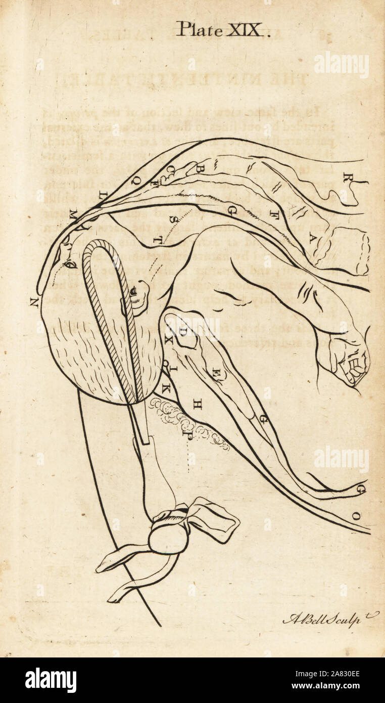 Foetus head brought lower down in the birth canal with forceps. Copperplate engraving by Andrew Bell after an illustration by Jan van Rymsdyk from William Smellie's A Set of Anatomical Tables, Charles Elliot, Edinburgh, 1780. Stock Photo