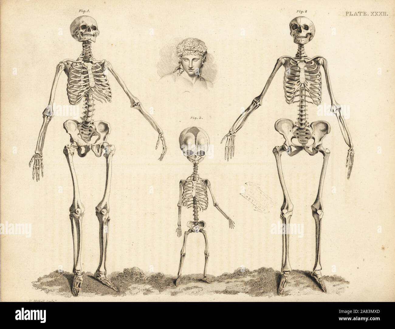 Comparison of the skeletons of the human male, female and foetus at birth. Copperplate engraving by Edward Mitchell after an anatomical illustration by Jean-Joseph Sue from John Barclay's A Series of Engravings of the Human Skeleton, MacLachlan and Stewart, Edinburgh, 1824. Stock Photo