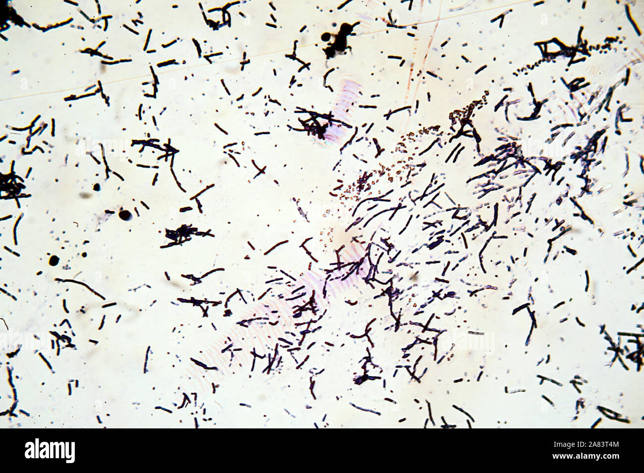 microscopic view of Gram staining Stock Photo