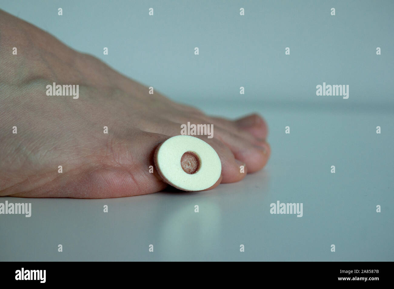 A corn plaster on the little toe of a foot, isolated on white background Stock Photo Alamy