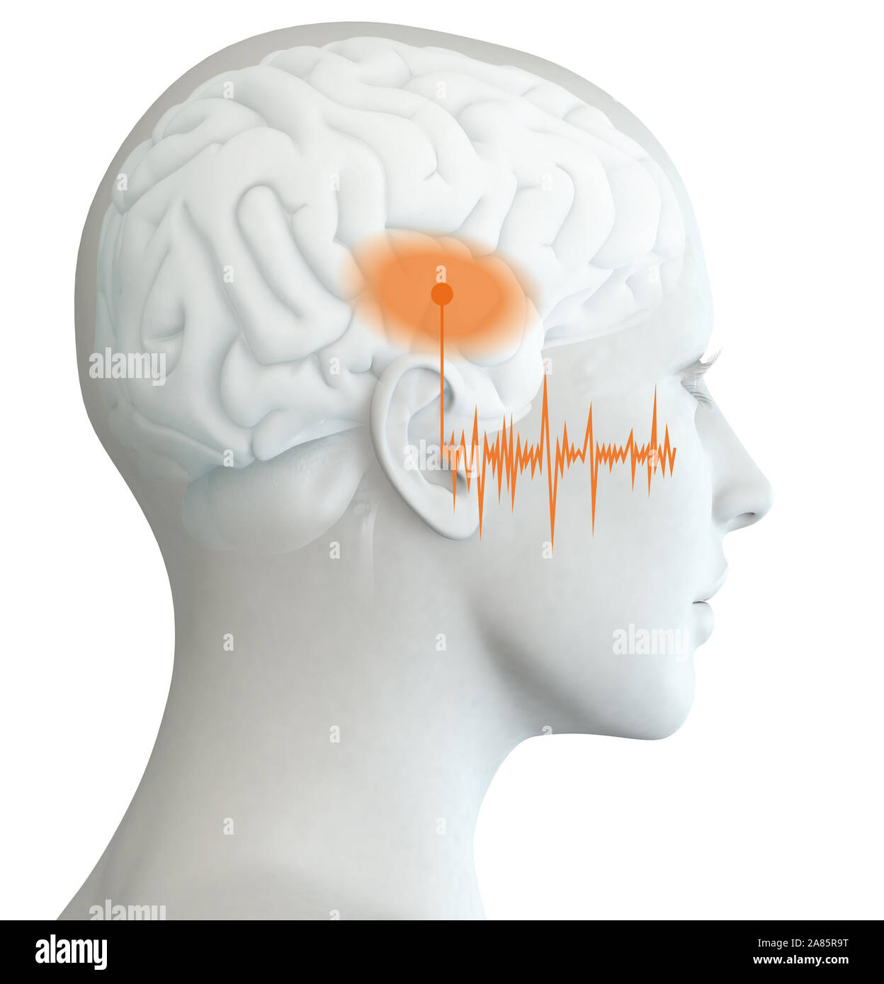 3D illustration showing human ear of a woman with marked auditory cortex and soundwave Stock Photo