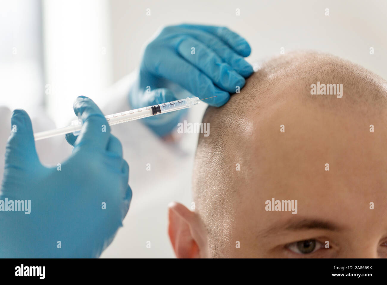 close up of hands with syringe and bald male head Stock Photo