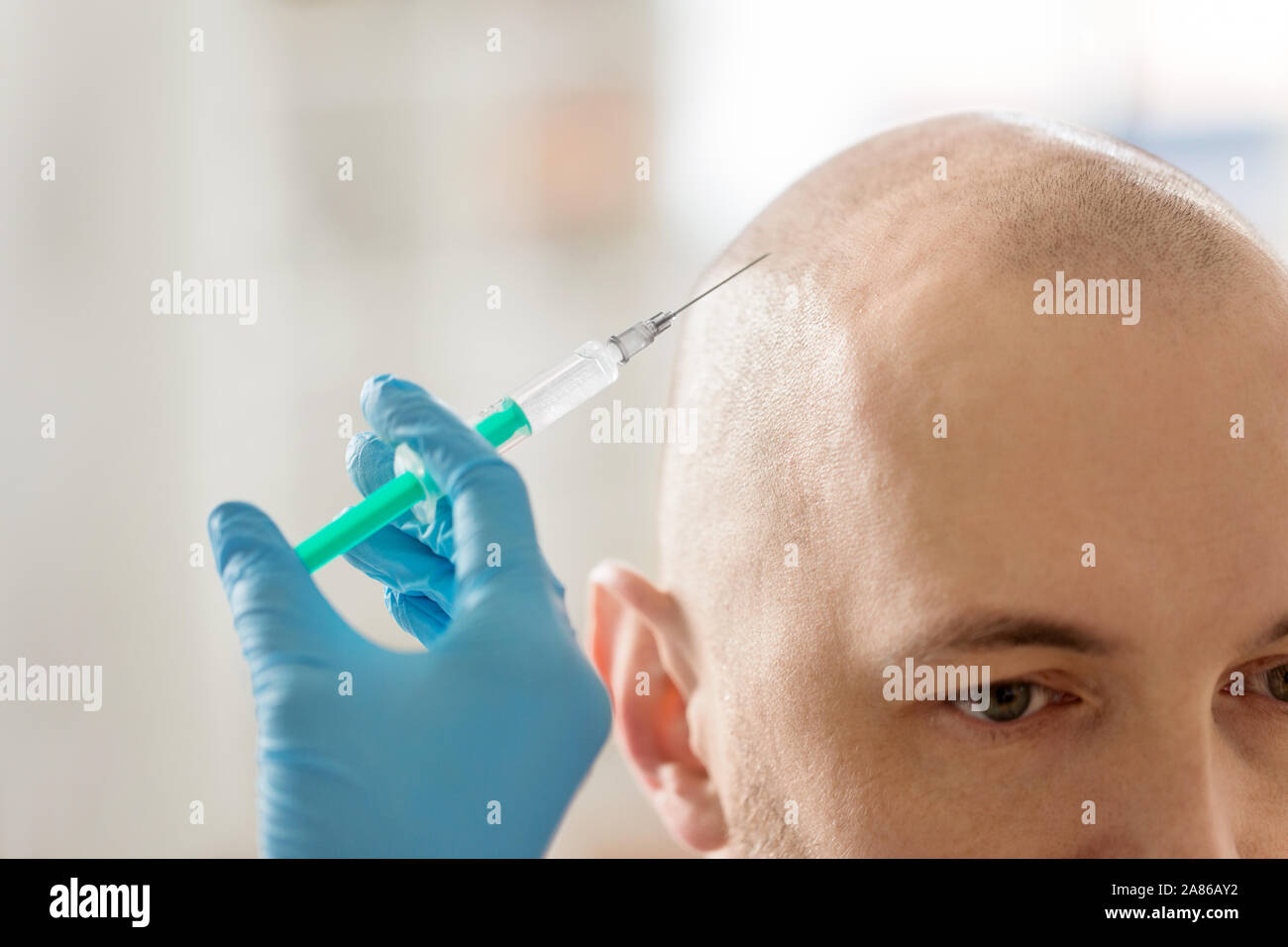 close up of hands with syringe and bald male head Stock Photo