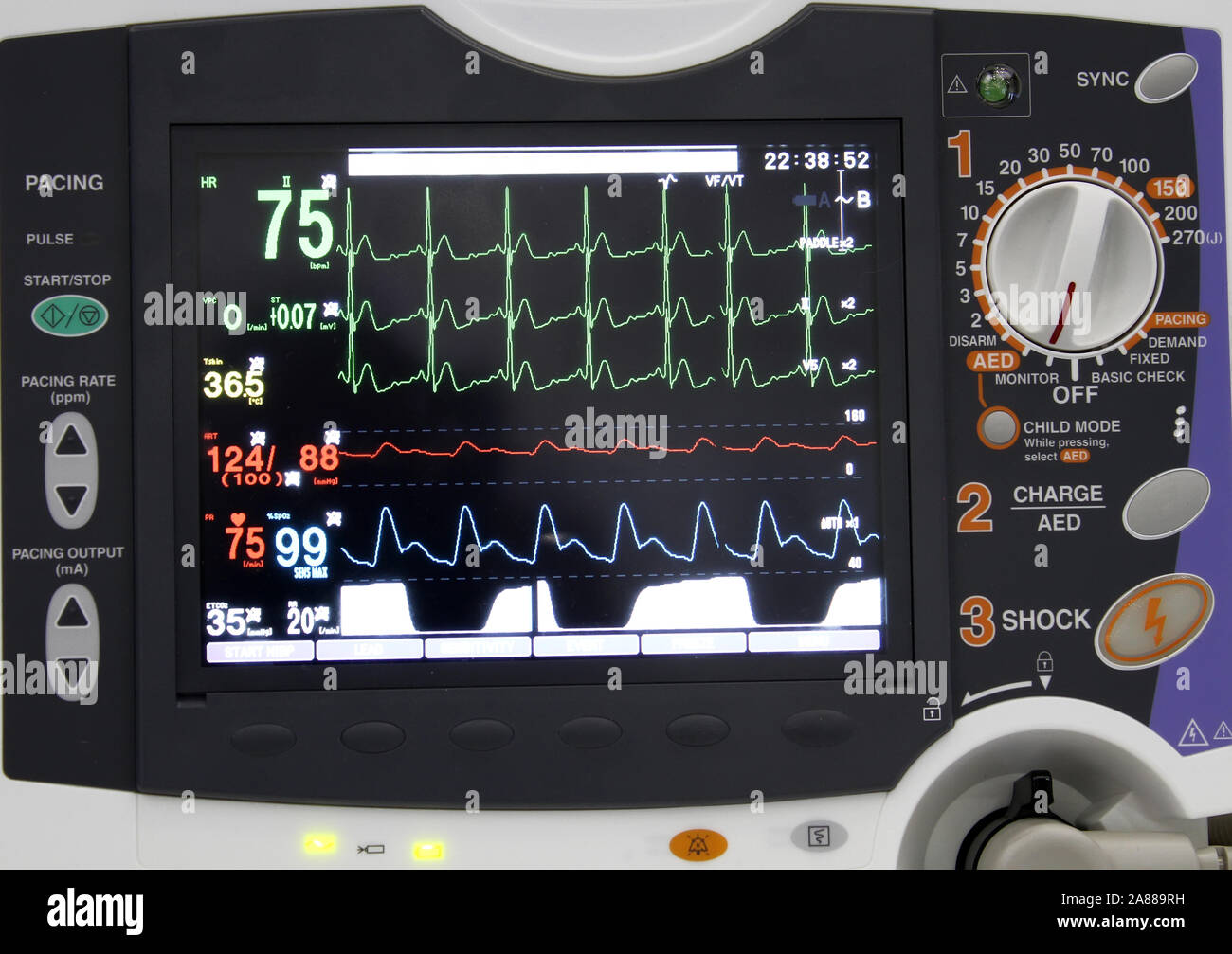 Ekg monitor patient hires stock photography and images Alamy