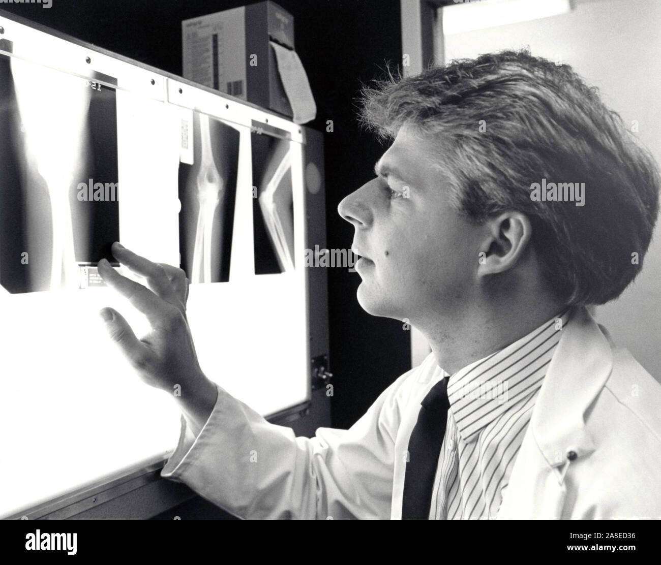 Radiology Department, University Hospital, Nottingham UK 1990 Stock