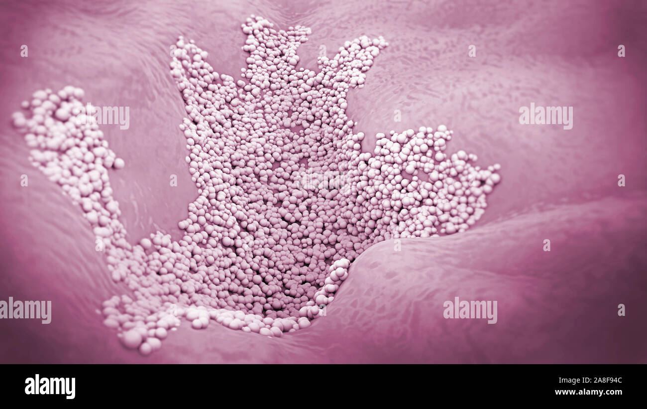 Fungal infection body hi-res stock photography and images - Alamy