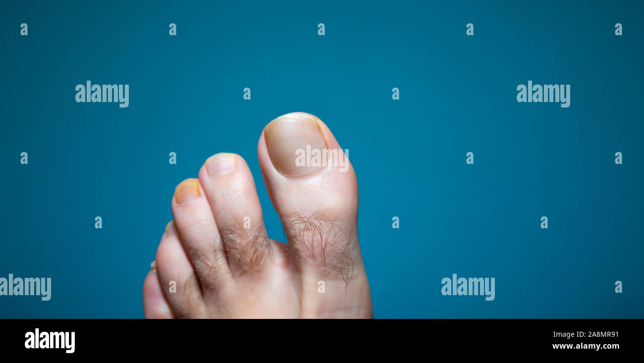 Hairy toes hires stock photography and images Alamy