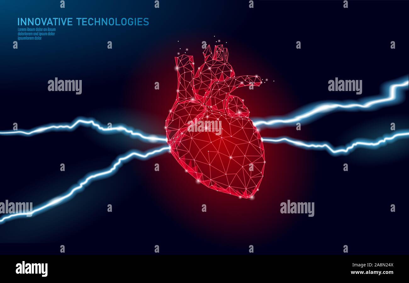 3D medicine heart attack warning. Human health diagnostics vascular organ system painful disease. Cardiology heart protect concept. Low poly vector Stock Vector