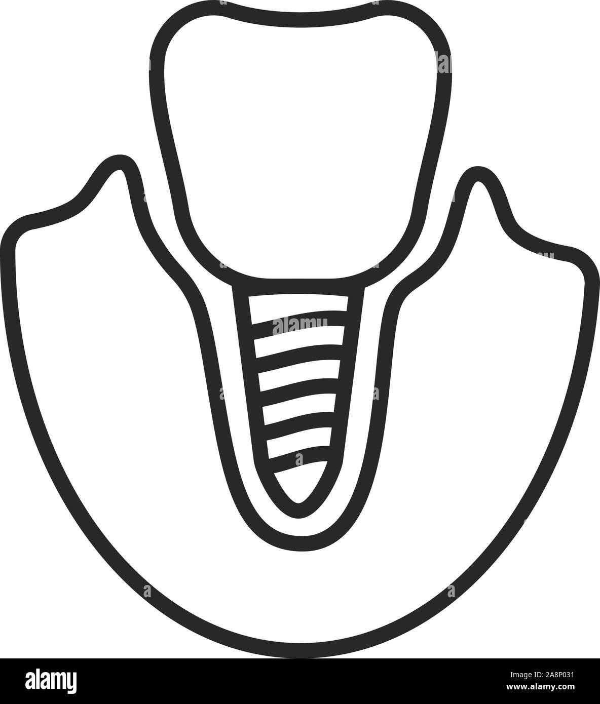 thin line icon of dental implant isolated on white Stock Vector