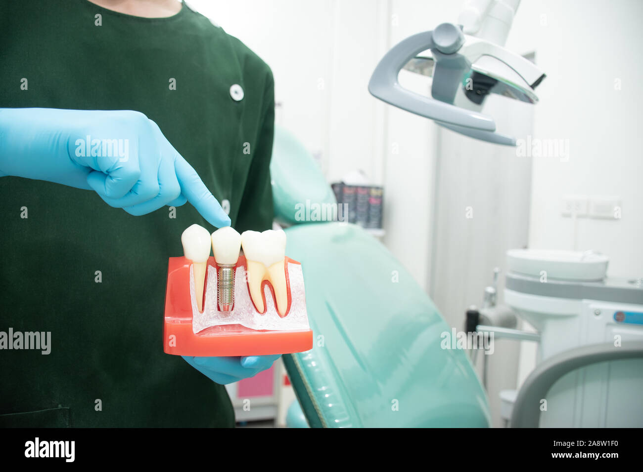 Male dentist in green uniform carrying a sample of dental implants compared with natural teeth to explain in detail. Is knowledge for patients before Stock Photo