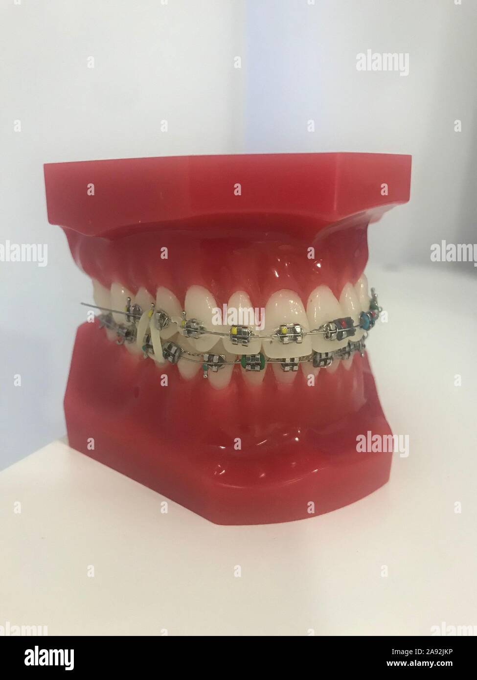 Medical Anatomical Model Soft Gingiva 28 Teeth with braces, Acrylic