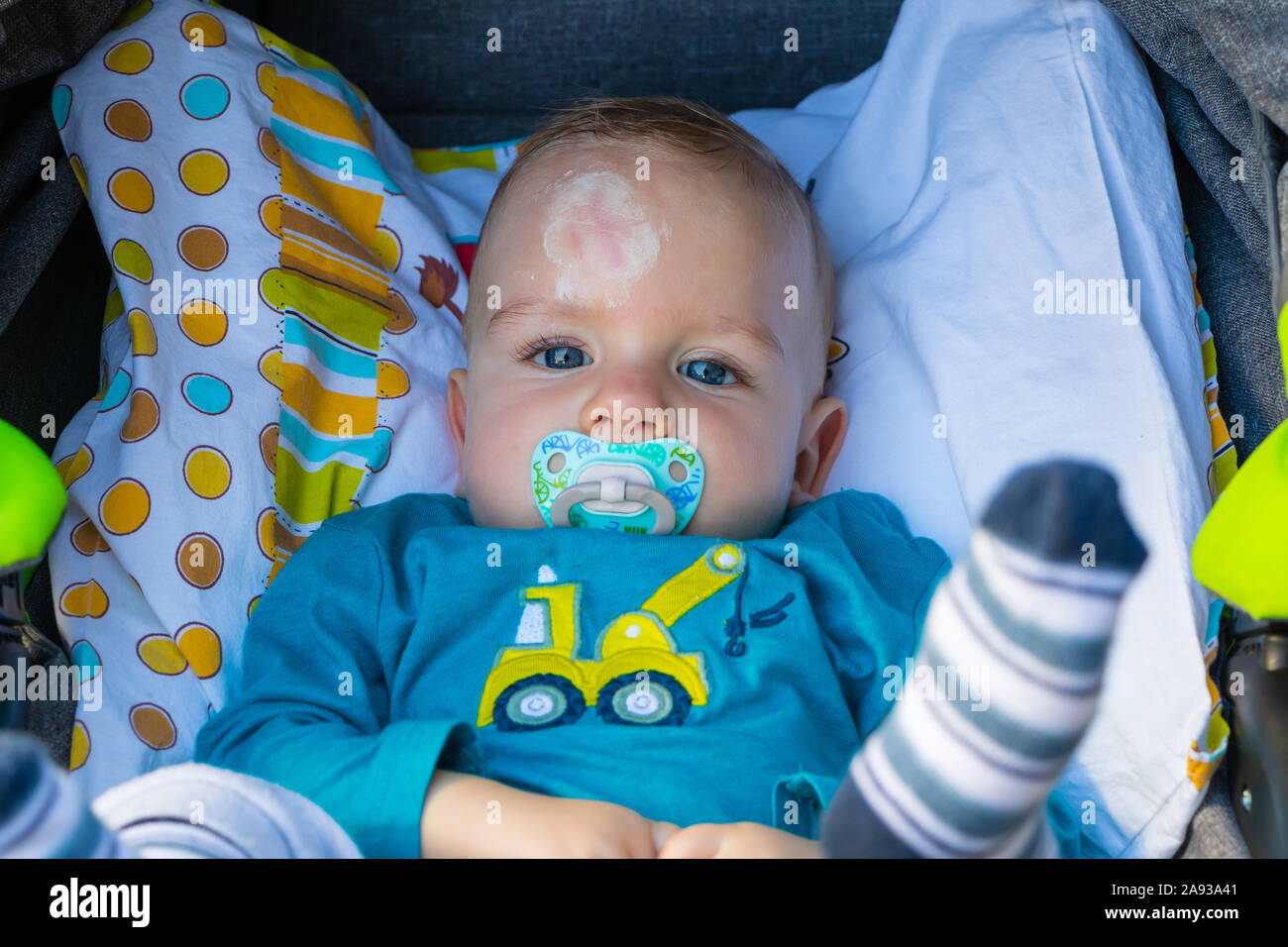 Close up of baby injury. Baby's expression and the scar on the forehead after he hits his head on the ground. Stock Photo