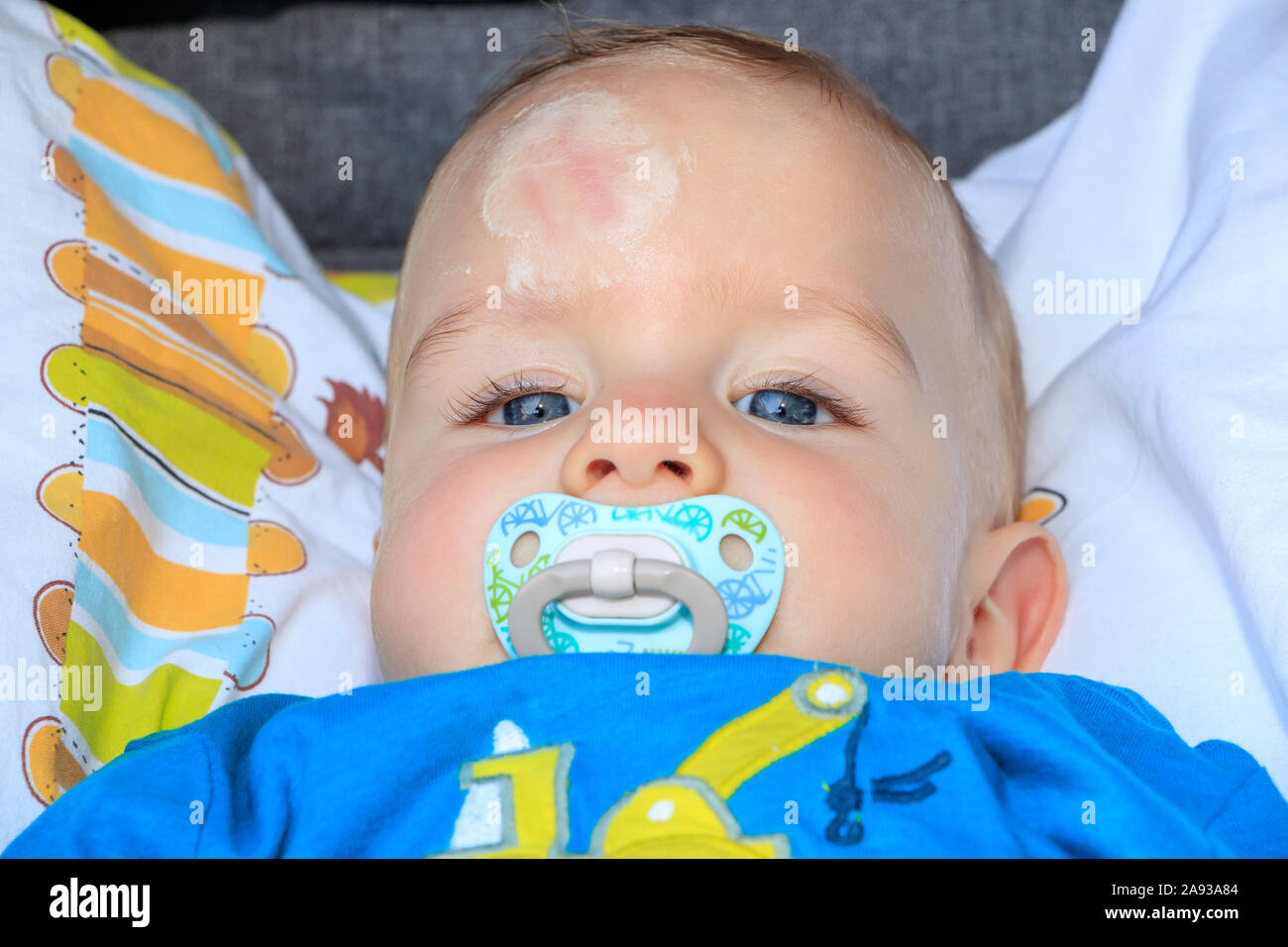 Close up of baby injury. Baby's expression and the scar on the forehead