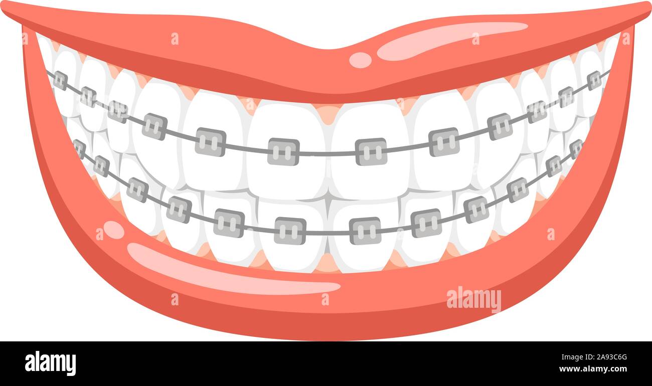 cartoon teeth with braces