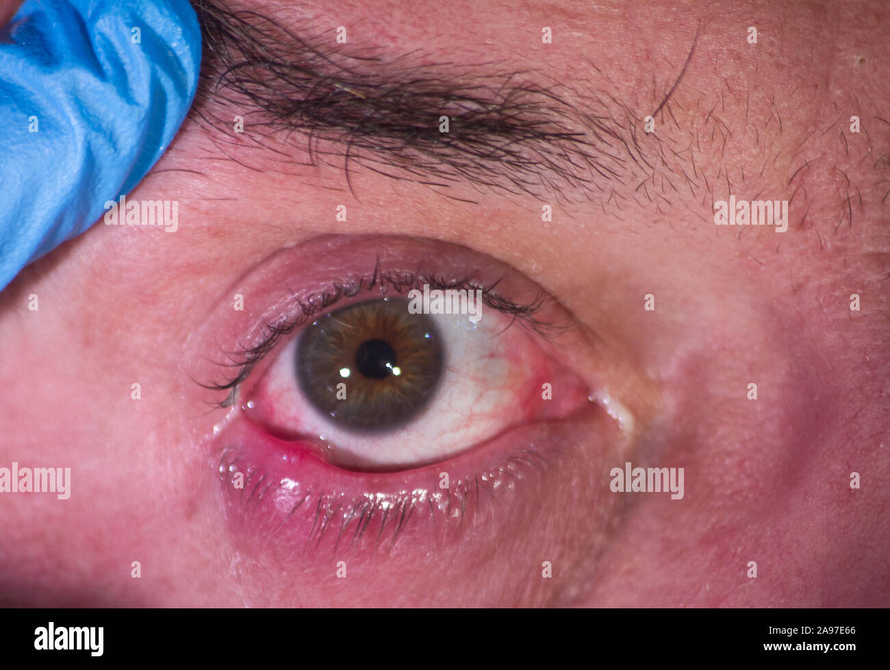 Yellow pus hires stock photography and images Alamy