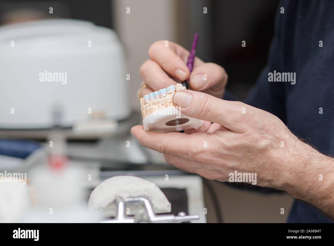 Dental plaster stone model work of making a bridge and crowns in