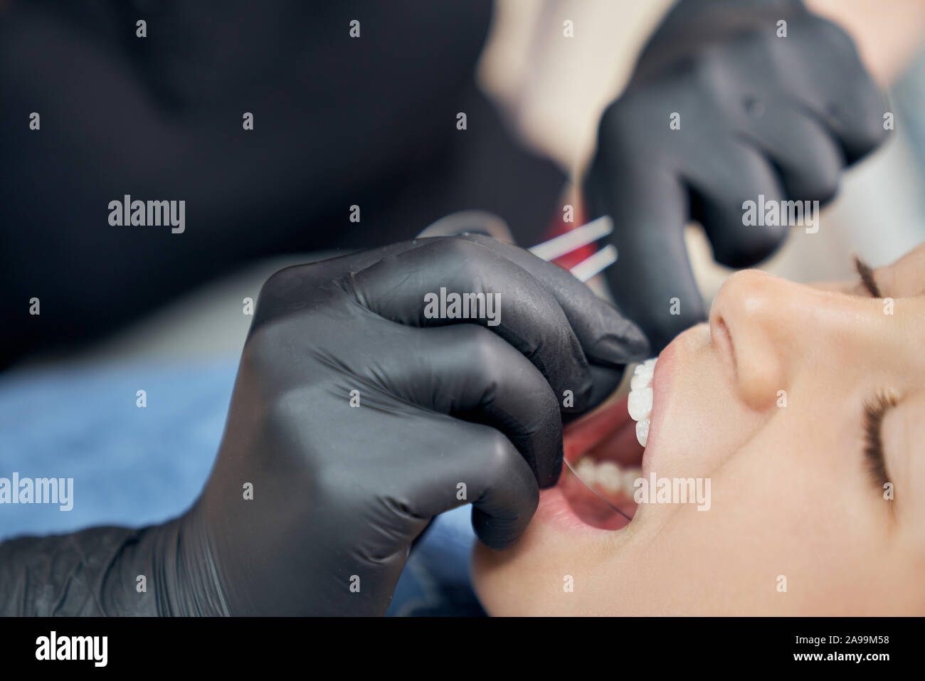 Close up of face of patient with opening mouth and hands of dentist in black rubber gloves. Doctor using metallic braces for alignment teeth of girl. Concept of health and beauty. Stock Photo