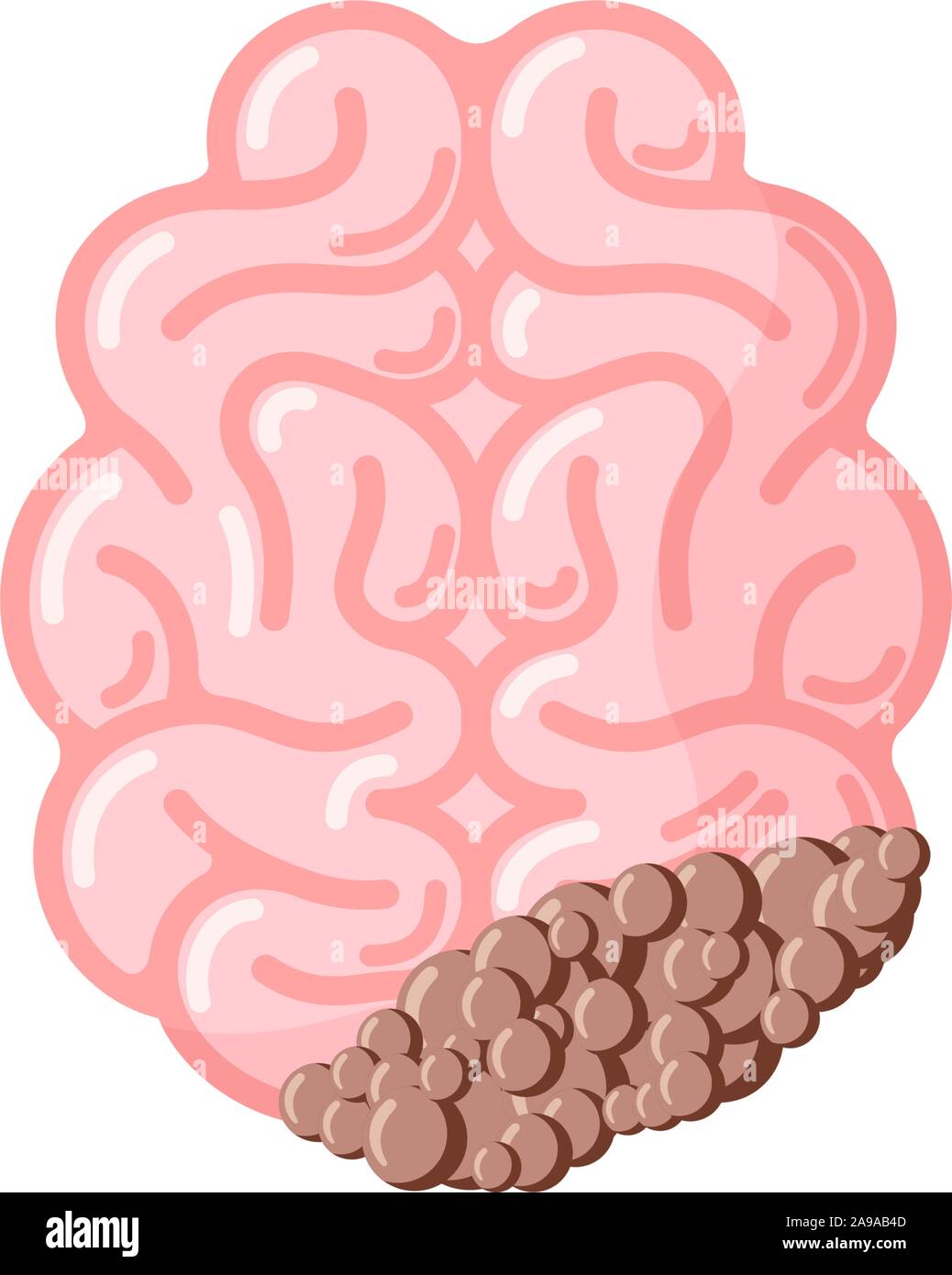 Human brain with cancer tumor. Sick suffering damage central nervous system organ. Vector eps illustration Stock Vector