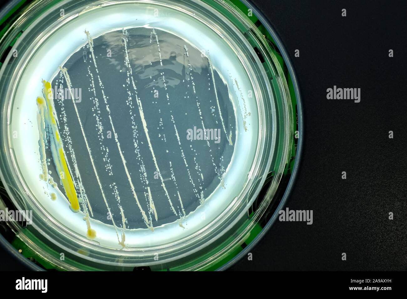 Bacteria on agar surface Stock Photo