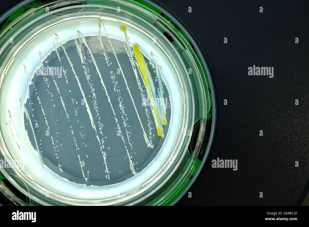 Bacteria on agar surface Stock Photo