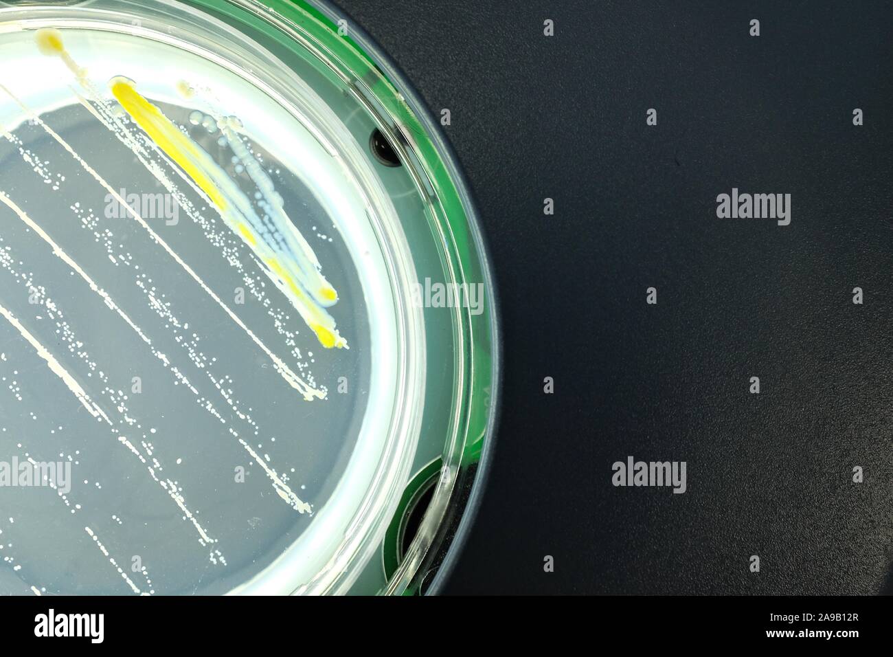 Bacteria on agar surface Stock Photo