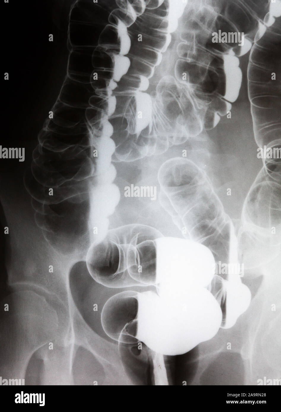 Soft x rays hires stock photography and images Alamy