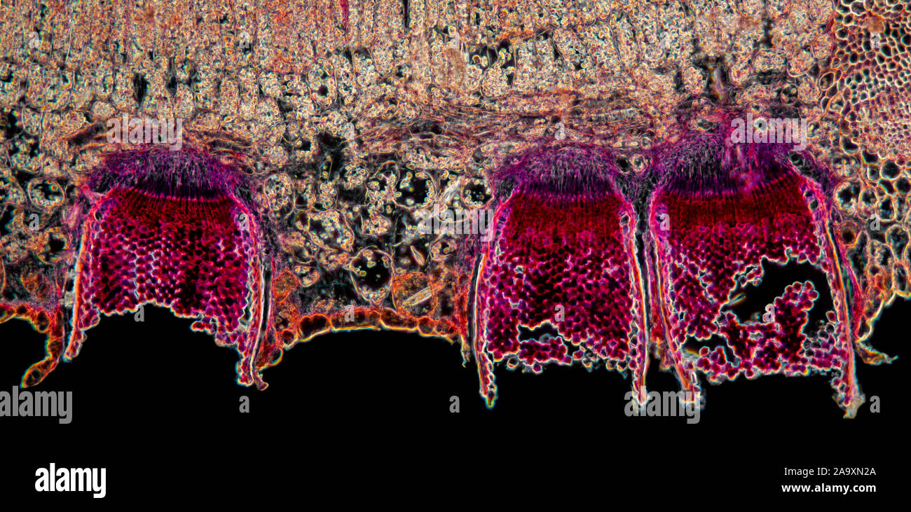 Aecidia in TS Berberis leaf, darkfield photomicrograph Stock Photo
