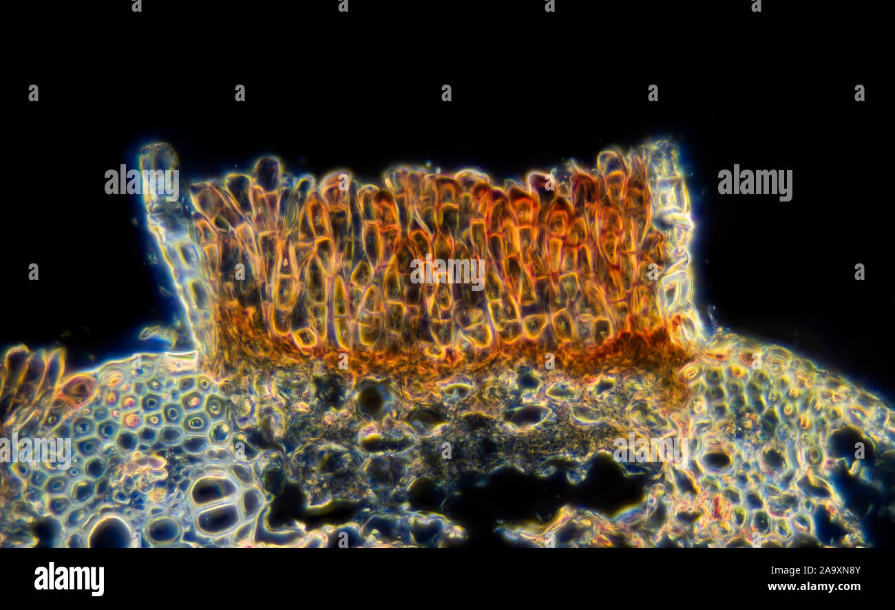 Fungi, Puccinia graminis, teleutospores in wheat stem, TS, Darkfield photomicrograph Stock Photo