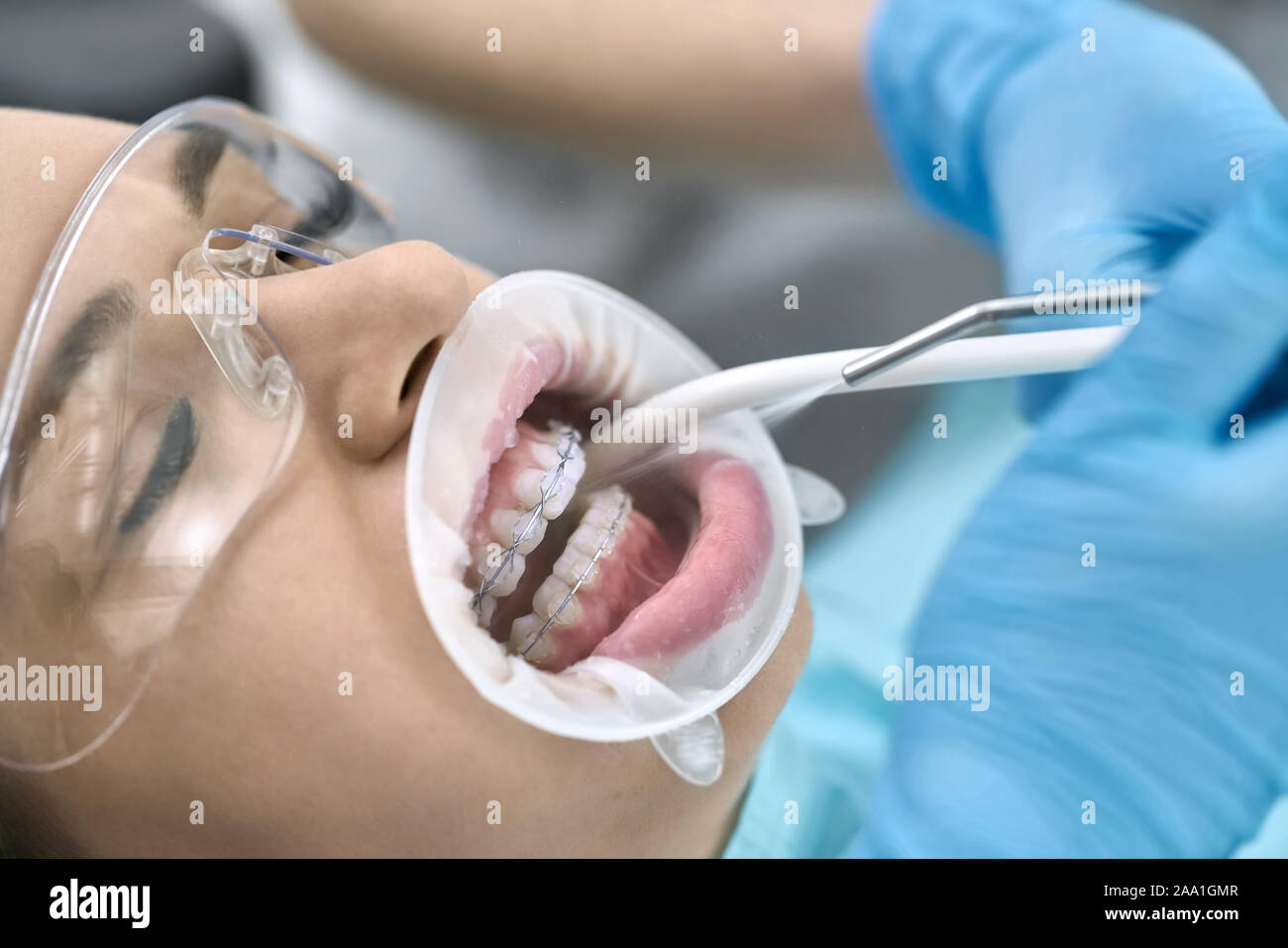 Woman with closed eyes in protective glasses with braces and a